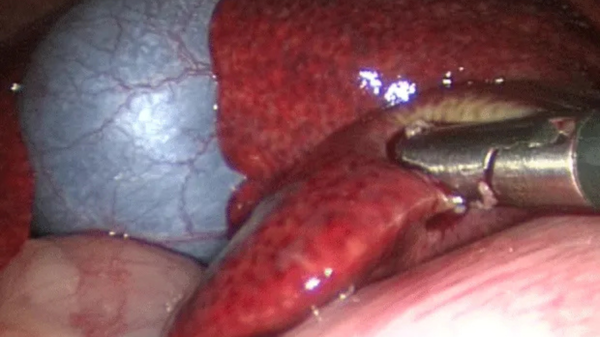 Physiotherapy & Rehabilitation